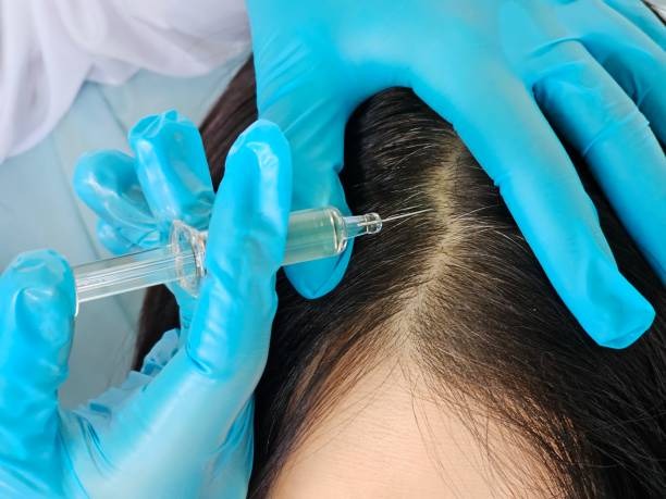 Hair Restoration Options to Restore Confidence and Natural Hair Growth